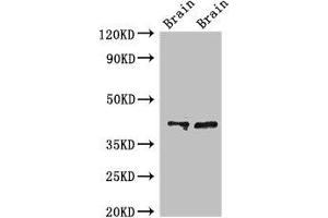 Western Blot Positive WB detected in: Rat brain tissue, Mouse brain tissue All lanes: CAMK1 antibody at 3 μg/mL Secondary Goat polyclonal to rabbit IgG at 1/50000 dilution Predicted band size: 42 kDa Observed band size: 42 kDa (CAMK1 抗体  (AA 166-265))