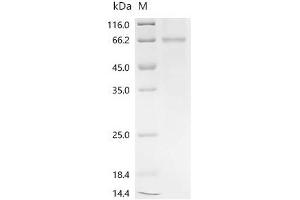 Eukaryotic Translation Elongation Factor 1 alpha 1 (EEF1A1) (AA 1-462), (full length) protein (His-SUMO Tag)