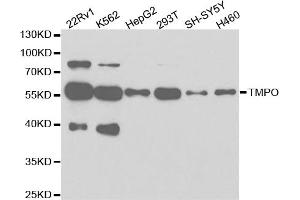 Western blot analysis of extracts of various cell lines, using TMPO antibody (ABIN5971365) at 1/1000 dilution. (Thymopoietin 抗体)