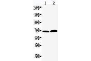 Western Blotting (WB) image for anti-Peptidyl Arginine Deiminase, Type IV (PADI4) (AA 492-512), (Middle Region) antibody (ABIN3042934)