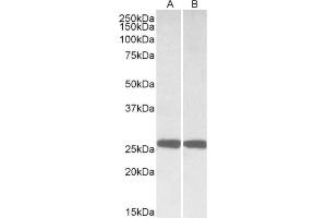 AP21291PU-N UCHL1 antibody staining of Mouse (A) and Rat (B) Brain lysates at 0. (UCHL1 抗体  (Internal Region))