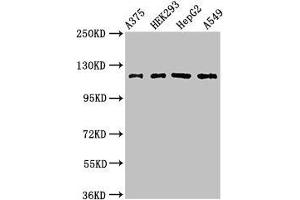 Western Blot Positive WB detected in: A375 whole cell lysate, HEK293 whole cell lysate, HepG2 whole cell lysate, A549 whole cell lysate All lanes: FARP1 antibody at 3 μg/mL Secondary Goat polyclonal to rabbit IgG at 1/50000 dilution Predicted band size: 119, 123, 15 kDa Observed band size: 119 kDa
