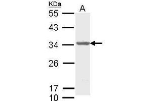 WB Image Sample (30 ug of whole cell lysate) A: Molt-4 , 12% SDS PAGE antibody diluted at 1:1000 (THO Complex 4 抗体)