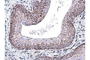 IHC-P Image COX5A antibody [N1C3] detects COX5A protein at mitochondria on mouse cervix by immunohistochemical analysis. (COX5A 抗体  (Center))