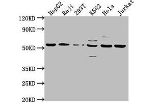 Western Blot Positive WB detected in: HepG2 whole cell lysate, Raji whole cell lysate, 293T whole cell lysate, K562 whole cell lysate, Hela whole cell lysate, Jurkat whole cell lysate All lanes: CAP1 antibody at 1:2000 Secondary Goat polyclonal to rabbit IgG at 1/50000 dilution Predicted band size: 52 kDa Observed band size: 52 kDa (CAP1 抗体  (AA 22-157))
