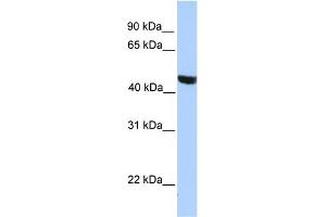WB Suggested Anti-MSL3L2 Antibody Titration:  0. (MSL3L2 抗体  (Middle Region))