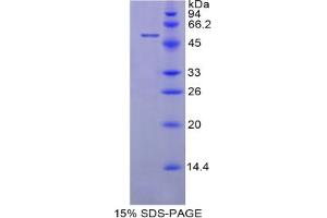 SDS-PAGE analysis of Cow LBP Protein. (LBP 蛋白)