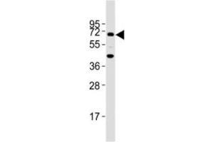 Western blot testing of TGFBR2 antibody at 1:2000 dilution + mouse lung lysate; Predicted molecular weight ~ 65 kDa. (TGFBR2 抗体  (AA 13-40))