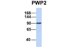 Host:  Rabbit  Target Name:  PWP2  Sample Type:  721_B  Antibody Dilution:  1. (PWP2 抗体  (Middle Region))