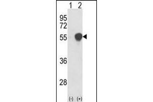 Western blot analysis of PHGDH (arrow) using rabbit polyclonal PHGDH Antibody (N-term) (ABIN389483 and ABIN2839543). (PHGDH 抗体  (N-Term))