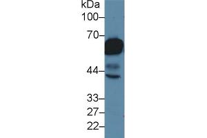 Detection of CK5 in Rat Tongue lysate using Polyclonal Antibody to Cytokeratin 5 (CK5) (Cytokeratin 5 抗体  (AA 163-471))