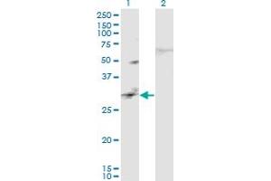 Western Blot analysis of CAPS2 expression in transfected 293T cell line by CAPS2 monoclonal antibody (M02), clone 3C6. (Calcyphosine 2 抗体  (AA 285-382))