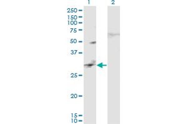 Calcyphosine 2 antibody  (AA 285-382)