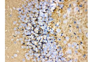 Anti-GAP43 antibody, IHC(P) IHC(P): Rat Brain Tissue (GAP43 抗体  (C-Term))