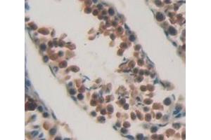 Figure. (CHEK1 抗体  (AA 194-446))