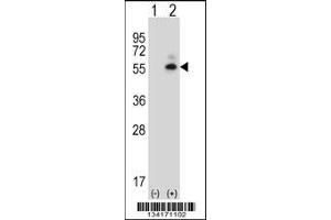 Western blot analysis of Camk2d using rabbit polyclonal Mouse Camk2d Antibody using 293 cell lysates (2 ug/lane) either nontransfected (Lane 1) or transiently transfected (Lane 2) with the Camk2d gene. (CAMK2D 抗体  (AA 221-250))