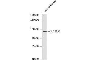 Western blot analysis of extracts of mouse kidney, using SLC22 antibody (ABIN6129479, ABIN6147886, ABIN6147888 and ABIN6218288) at 1:1000 dilution. (SLC22A2 抗体  (AA 44-140))