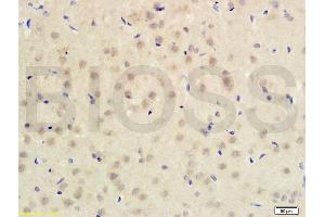 Formalin-fixed and paraffin embedded rat brain tissue labeled with Anti-PITX3 Polyclonal Antibody (ABIN679988) , Unconjugated at 1:200 followed by conjugation to the secondary antibody