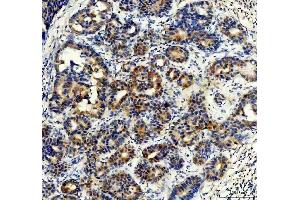 IHC analysis of Synip/STXBP4 using anti-Synip/STXBP4 antibody (ABIN7602066). (STXBP4 抗体  (AA 57-481))