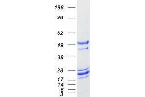 Western Blotting (WB) image for Growth Arrest and DNA-Damage-Inducible, alpha (GADD45A) protein (Myc-DYKDDDDK Tag) (ABIN2721553)