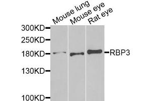 Western blot analysis of extracts of various cells, using RBP3 antibody. (RBP3 抗体)