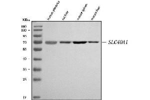 Western blot analysis of SLC40A1 using anti-SLC40A1 antibody (ABIN7599484).