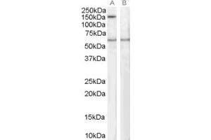 Western Blotting (WB) image for anti-Signal-Induced Proliferation-Associated 1 (SIPA1) (C-Term) antibody (ABIN2466269) (SIPA1 抗体  (C-Term))
