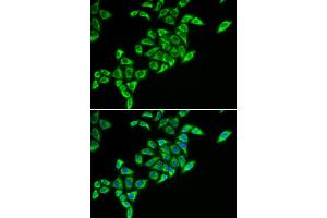 Immunofluorescence (IF) image for anti-Dihydrolipoyl Transacetylase (DLAT) antibody (ABIN1980304) (DLAT 抗体)