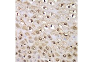 Immunohistochemistry of paraffin-embedded human esophagus using INTS5 antibody  at dilution of 1:100 (40x lens). (INTS5 抗体  (AA 120-400))