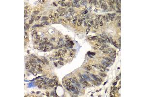 Immunohistochemistry of paraffin-embedded human colon using UFD1L antibody at dilution of 1:100 (x40 lens).