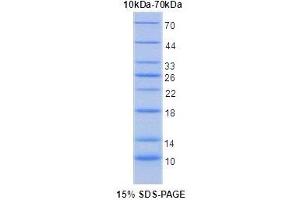 Image no. 2 for Interleukin 5 Receptor, alpha (IL5RA) protein (ABIN6306054) (IL5RA 蛋白)