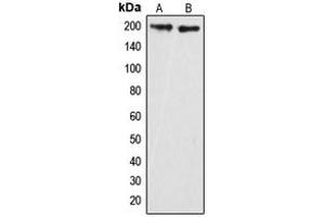 Western blot analysis of GRLF1 (pY1087) expression in HeLa (A), mouse brain (B) whole cell lysates. (GRLF1 抗体  (pTyr1087))