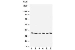 Western blot testing of ARC antibody and human samples 1:  SMMC-7721 (NOL3 抗体  (AA 91-106))