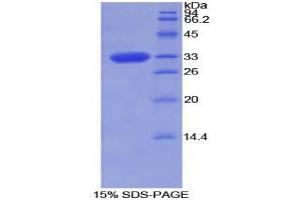SDS-PAGE analysis of Rat Torsin 2A Protein. (TOR2A 蛋白)