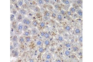 Immunohistochemistry (Paraffin-embedded Sections) (IHC (p)) image for anti-Staphylococcal Nuclease Domain Containing Protein 1 (SND1) antibody (ABIN7008236)