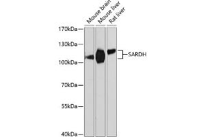 Western blot analysis of extracts of various cell lines, using SARDH Antibody (ABIN6128753, ABIN6147379, ABIN6147380 and ABIN6225034) at 1:3000 dilution. (SARDH 抗体  (AA 300-560))