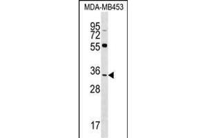 FKBP6 Antibody (C-term) (ABIN1536953 and ABIN2848611) western blot analysis in MDA-M cell line lysates (35 μg/lane). (FKBP6 抗体  (C-Term))