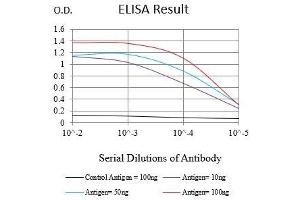 Black line: Control Antigen (100 ng),Purple line: Antigen (10 ng), Blue line: Antigen (50 ng), Red line:Antigen (100 ng) (Ki-67 抗体  (AA 1160-1493))