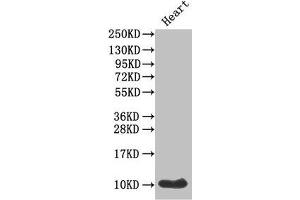Western Blot Positive WB detected in: Mouse heart tissue All lanes: IAPP antibody at 1 μg/mL Secondary Goat polyclonal to rabbit IgG at 1/50000 dilution Predicted band size: 10 kDa Observed band size: 10 kDa (Amylin/DAP 抗体  (AA 34-70))