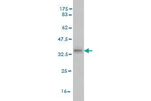 Western Blot detection against Immunogen (35. (RAB2B 抗体  (AA 127-216))