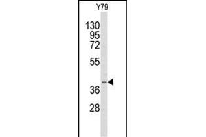 Western blot analysis of anti-AKR1A1 Antibody (C-term) (ABIN389204 and ABIN2837921) in Y79 cell line lysates (35 μg/lane).