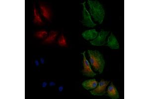 ABIN6261634 and ABIN6269150 staining  cells by IF/ICC. (Ezrin 抗体  (C-Term))