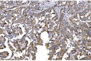 IHC analysis of HGS using anti-HGS antibody (ABIN7601206).