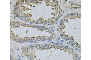 Immunohistochemistry of paraffin-embedded Human prostate using DBI Polyclonal Antibody at dilution of 1:100 (40x lens). (Diazepam Binding Inhibitor 抗体)