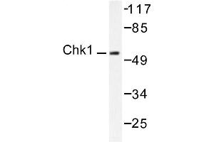 Image no. 1 for anti-Checkpoint Kinase 1 (CHEK1) antibody (ABIN265347) (CHEK1 抗体)