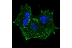 Fluorescent confocal image of MCF7 cells stained with phospho-ERBB2- antibody. (ErbB2/Her2 抗体  (pTyr1196))