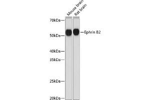Western blot analysis of extracts of various cell lines, using Ephrin B2 Rabbit mAb (ABIN7266978) at 1:1000 dilution. (Ephrin B2 抗体)