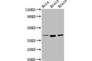 Western Blot Positive WB detected in: Hela whole cell lysate, Rat brain tissue, Mouse brain tissue All lanes: ERGIC2 antibody at 2. (ERGIC2 抗体  (AA 55-310))