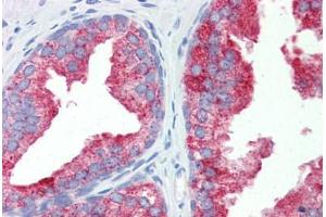 Human Prostate (formalin-fixed, paraffin-embedded) stained with NR1I3 antibody ABIN462245 followed by biotinylated goat anti-rabbit IgG secondary antibody ABIN481713, alkaline phosphatase-streptavidin and chromogen.