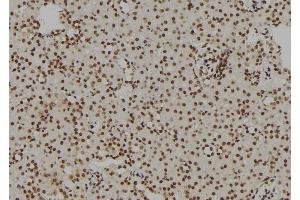 ABIN6269157 at 1/100 staining Rat kidney tissue by IHC-P. (GATA1 抗体  (Internal Region))